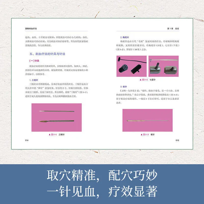 Therapy Health And Wellness - คำอธิบายเกี่ยวกับการบำบัดด้วยการเจาะเลือด: คู่มือภาพประกอบด้านการแพทย์แผนจีนเกี่ยวกับแนวทางการดูแลสุขภาพและการส่งเสริมความเป็นอยู่ที่ดี รวมถึงสารานุกรมทางการแพทย์